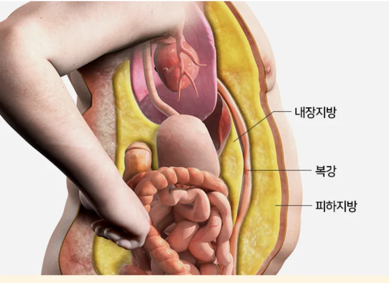 뱃살빼는 법? 내장지방 빼는 법! [영등포 당산 한의원]