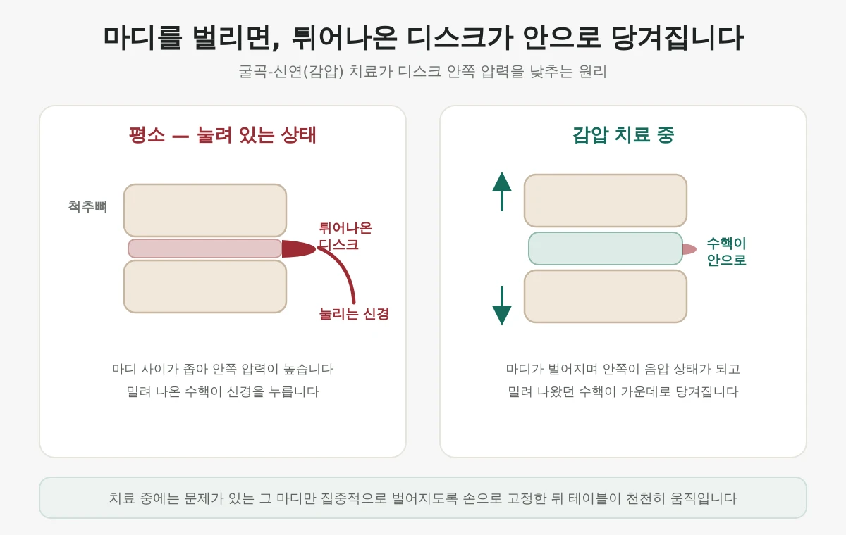 디스크·척추관 협착증, 수술 전에 해볼 수 있는 감압 치료 | 영등포 당산 해수원한의원