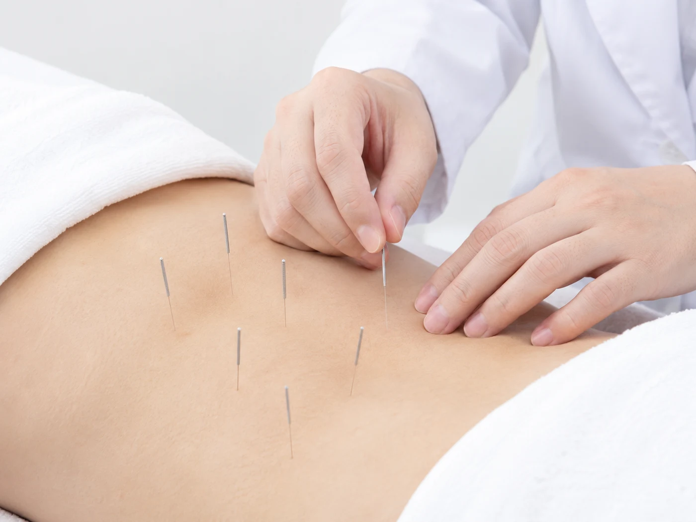 허리 주변 혈자리에 침을 놓는 산후 치료 장면